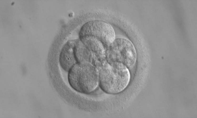 Top 5 Best IVF Doctor in Hyderabad with High Success Rate 2021