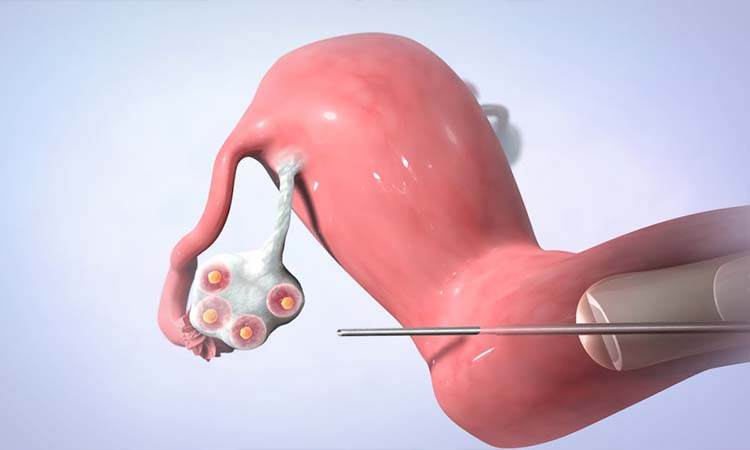 Top 5 Best IVF Doctors in Nagpur With High Success Rate 2022