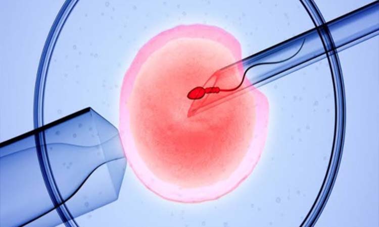 IVF Cost in Jamshedpur: Test Tube Baby Cost in Jamshedpur, Low-cost IVF Centres in Jamshedpur