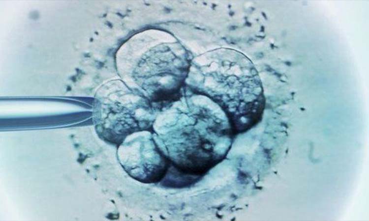 Best IVF Centres in Katihar, Bihar, Cost of IVF in Katihar, Bihar 
