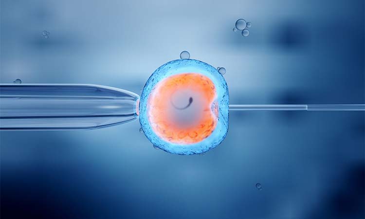 Best IVF Centres in Munger, Bihar, Cost of IVF in Munger, Bihar