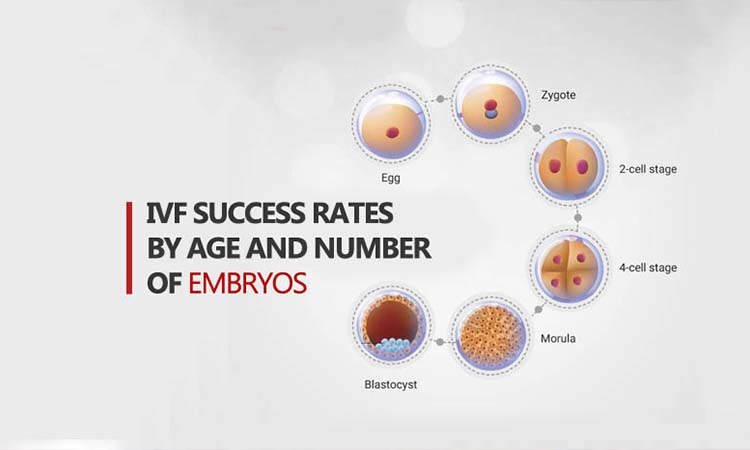 Best IVF Centres in Datia, Madhya Pradesh, Cost of IVF in Datia, Madhya Pradesh