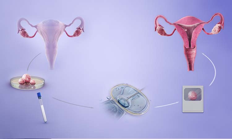 IVF Cost in Chandrapur: Test Tube Baby Cost in Chandrapur, Low-cost IVF Centres in Chandrapur