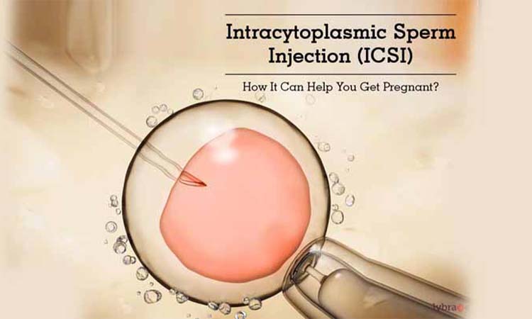 ICSI Treatment