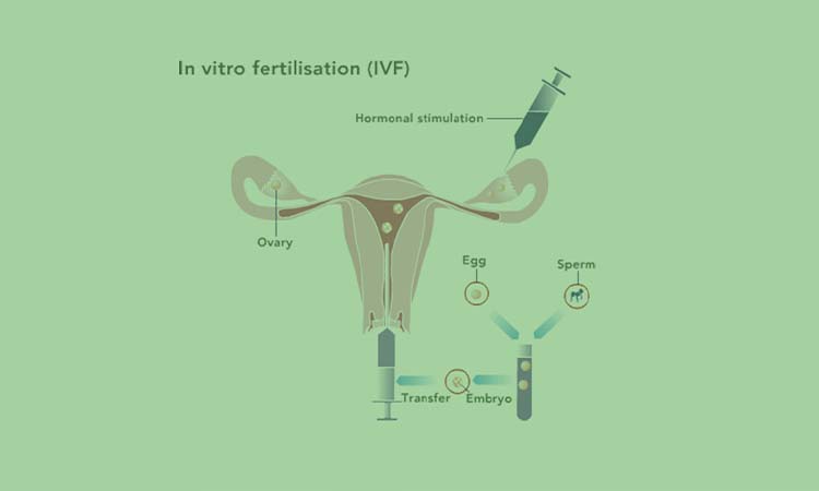 Best IVF Treatment in Nagapattinam, Tamil Nadu with High Success Rate