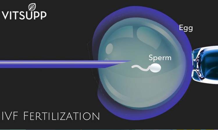 IVF Cost in Gudiyatham: Test Tube Baby Cost in Gudiyatham, Low-cost IVF Centres in Gudiyatham