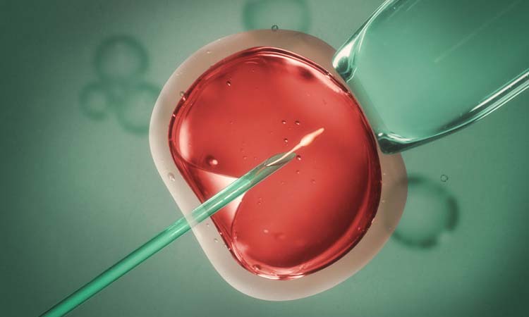 IVF Cost in Akola: Test Tube Baby Cost in Akola, Low-cost IVF Centres in Akola