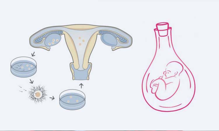 IVF Cost in Hindupur: Test Tube Baby Cost in Hindupur, Low-Cost IVF Centres in Hindupur