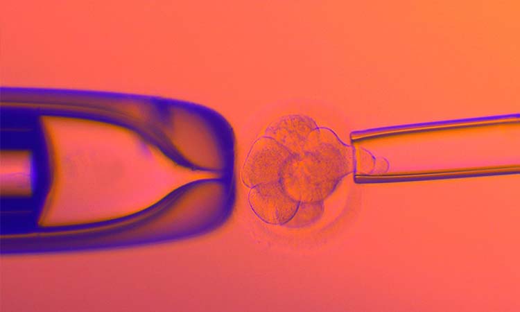 Best IVF Centres in Modasa, Madhya Pradesh, Cost of IVF in Modasa, Madhya Pradesh