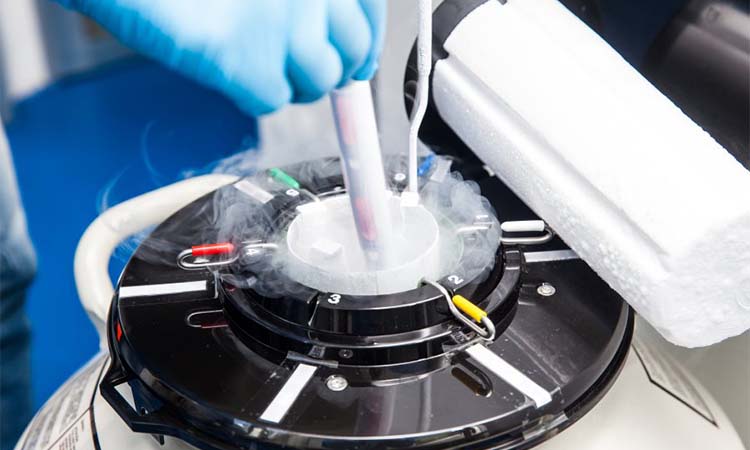 IVF Cost in Bangalore: Test Tube Baby Cost in Bangalore, Low-cost IVF Centres in Bangalore