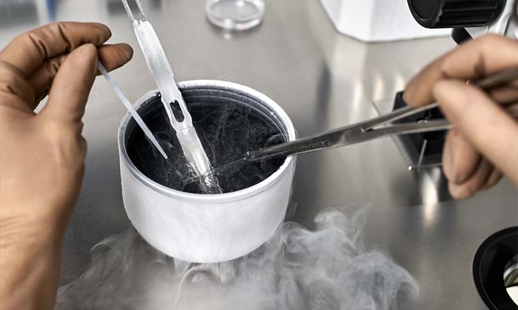 IVF Cost in Belgaum: Test Tube Baby Cost in Belgaum, Low-cost IVF Centres in Belgaum