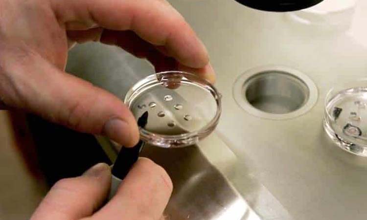 IVF Cost in Bhopal: Test Tube Baby Cost in Bhopal, Low-cost IVF Centres in Bhopal