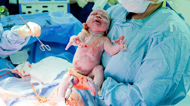 Surrogacy Cost in Lucknow: Surrogate Mother Cost in Lucknow, Low-cost Surrogacy Centres in Lucknow