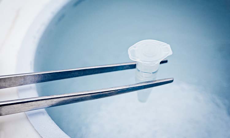 IVF Cost in Bidar: Best IVF Treatment in Bidar with High Success Rate