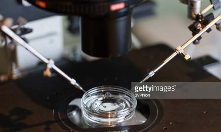 IVF Cost in Neyveli: Test Tube Baby Cost in Neyveli, Low-cost IVF Centres in Neyveli