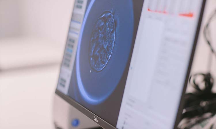 IVF Cost in Gadag: Test Tube Baby Cost in Gadag, Low-cost IVF Centres in Gadag