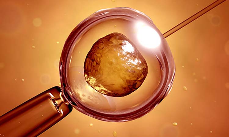 IVF Cost in Guntur: Test Tube Baby Cost in Guntur, Low-cost IVF Centres in Guntur