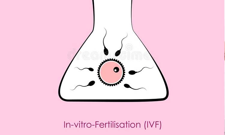 IVF Cost in Ukraine: Test Tube Baby Cost in Ukraine, Low-cost IVF Centres in Ukraine