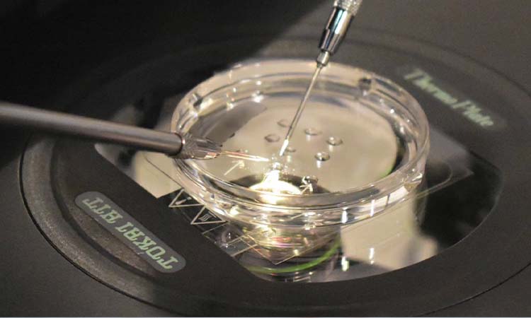 IVF Cost in Vaniyambadi: Test Tube Baby Cost in Vaniyambadi, Low-cost IVF Centres in Vaniyambadi