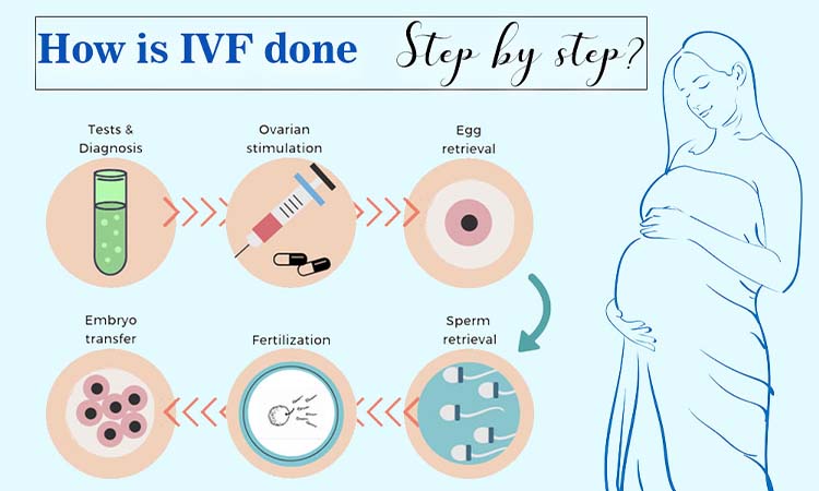 IVF Procedures & Fee