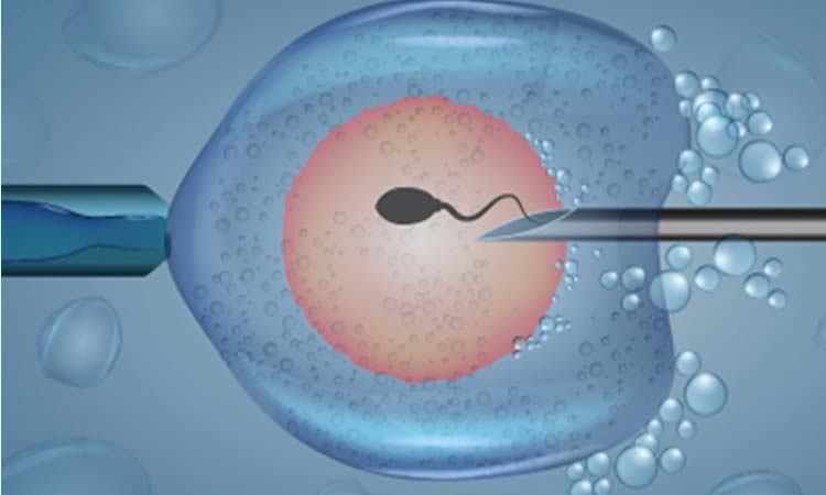 IVF Programs
