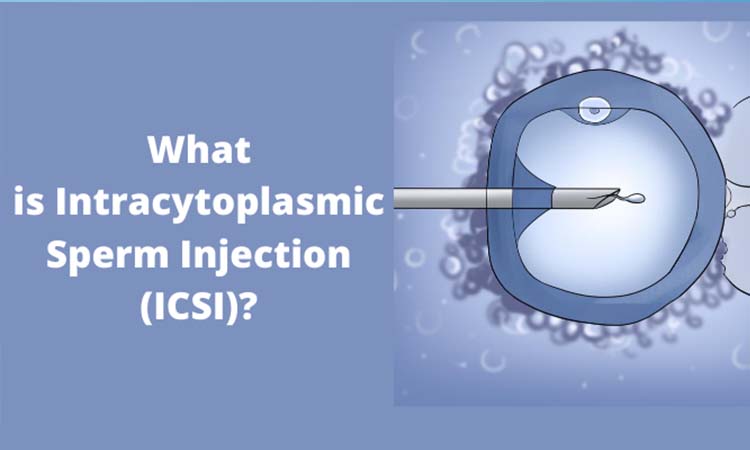 Top 4 Best ICSI Treatment Centres in Gandhinagar 2021